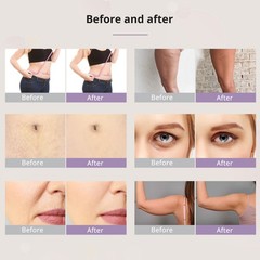 New 6 in 1 Beauty Machine for Skin Smoothing & Silhouette Improvement Massage