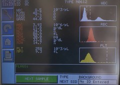Abbott Cell-Dyn Emerald Hematology System