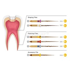 AZDENT Dental Endodontic Gold Taper NITI Rotary Files Engine Use 25mm 6PCS/Packs