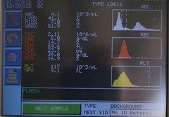 Abbott Cell-Dyn Emerald Hematology System
