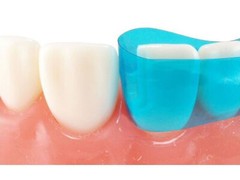 Dental Blue Strip M8 Contoured Anterior Matrix Restoration Matrices 0.05mm