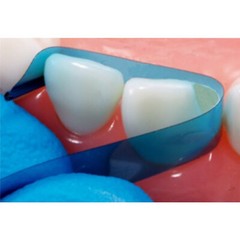 Dental Blue Strip M8 Contoured Anterior Matrix Restoration Matrices 0.05mm