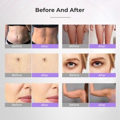 Pro 9 in 1 Beauty Machine for Body Massage Facial Care Skin Lifting Lost Weig87