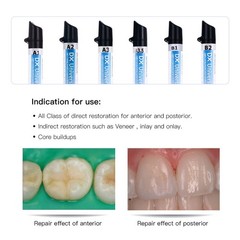 Dentex Dental Universal Composite Resin Light Cure A1/A2/A3/A3.5/B1
