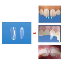 Dental Clear Matrix Anterior Matrices Bow BT Fits Bioclear L/M/S Matrice TOR VM