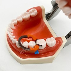 Dental Matrix Bands Ring Sectional Matrice Clamp Fit Garrison Palodent V3 System