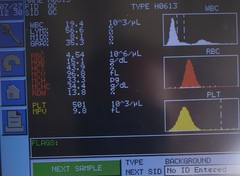 Abbott Cell-Dyn Emerald Hematology System