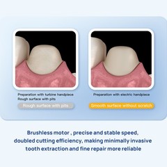 Dental Electric Brushless Surgery Motor System Touch/1:1/1:5/1:4.2 LED Handpiece