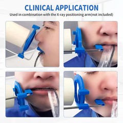 5PCS Dental X-Ray Aiming Ring Kit for Anterior Blue Autoclavable