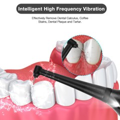 Electric Sonic Teeth Cleaner Dental Calculus Remover Scaler Tooth Cleaning Tools