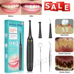 Ultrasonic Dental Scaler Calculus Tartar Remove Teeth Clean Tool Tooth Whitening