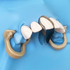 Dental Anterior Twin Matrices Cervical Matrix Blue Strip M8 Restoration Matrices