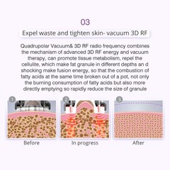 9 in 1 Beauty Machine Body Massage Facial Skin Care Skin Care Brand New US