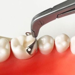 50 Pcs Dental Matrix Bands Palodent V3 Style Sectional Contoured Matrices 4 Size