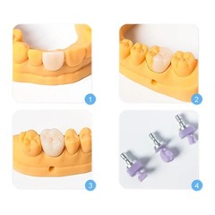 C14 Dental Lithium Disilicate Glass-ceramic Blocks HT/LT Emax Chairside CAD/CAM