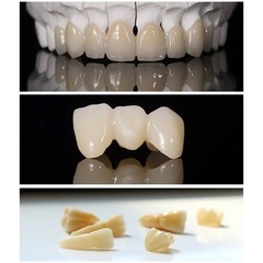 US C14 Emax Dental Glass Ceramic HT LT Lithium Dislicate CAD/CAM Cerec Blocks