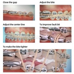 10X AZDENT Dental Orthodontic Super Elastic Niti Reverse Curve Round Arch Wires
