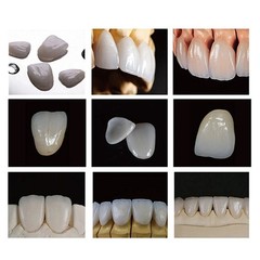US C14 Emax Dental Glass Ceramic HT LT Lithium Dislicate CAD/CAM Cerec Blocks