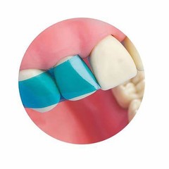 Dental Blue Strip Anterior Matrix Strips IV Composite Matrices Bands
