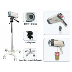 Electronic Digital Colposcope Video HD For Gynecology Colposcopy Imaging System