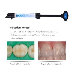 Dental Universal Light Cure Composite Veneer Teeth Resin SyringeA1 A2 A3 A3.5 B1