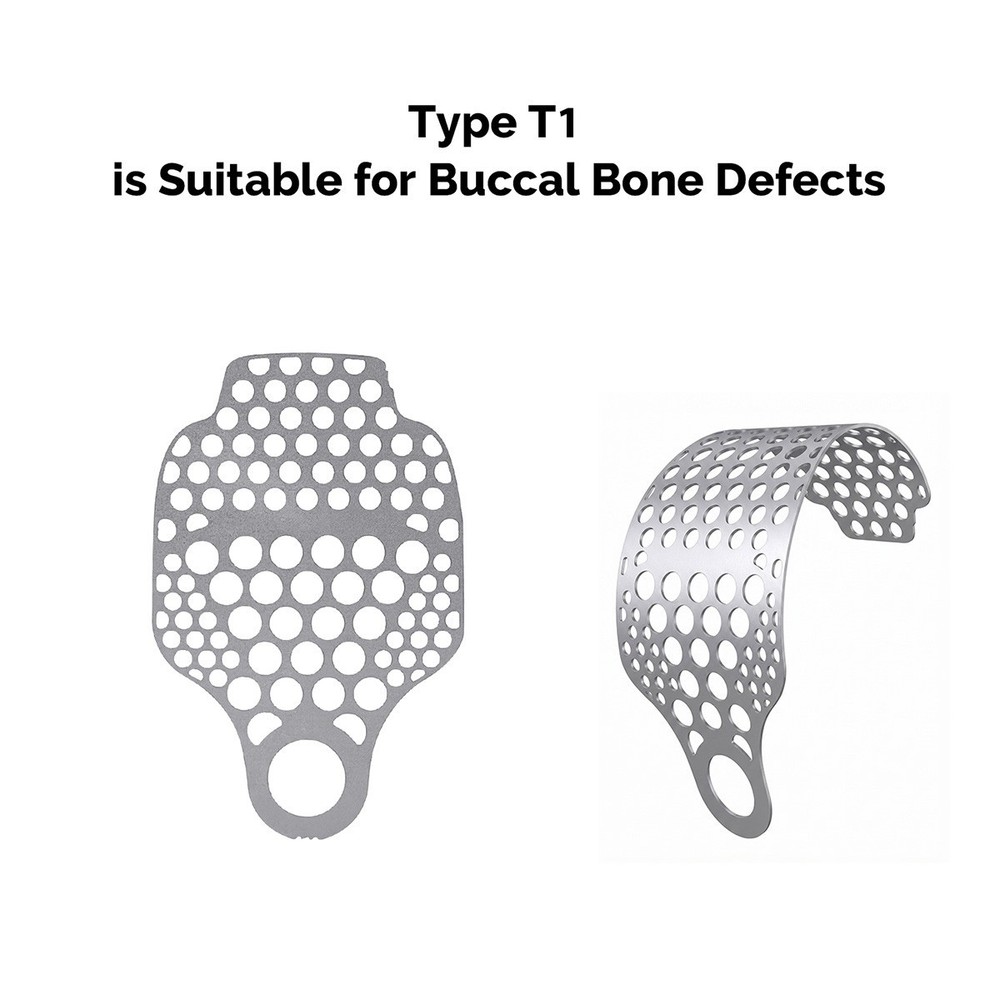 Dental Titanium Mesh Membrane Guided Bone Regeneration GBR Plate 5 Types