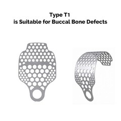 Dental Titanium Mesh Membrane Guided Bone Regeneration GBR Plate 5 Types