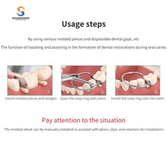 Dental Matrix Bands Anterior Proximal Strips Sectional Contoured Matrices Twin