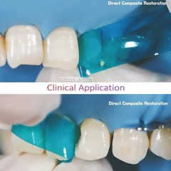 50x Dental Blue Strip M8 Contoured Anterior Matrix Restoration Matrices 0.05mm